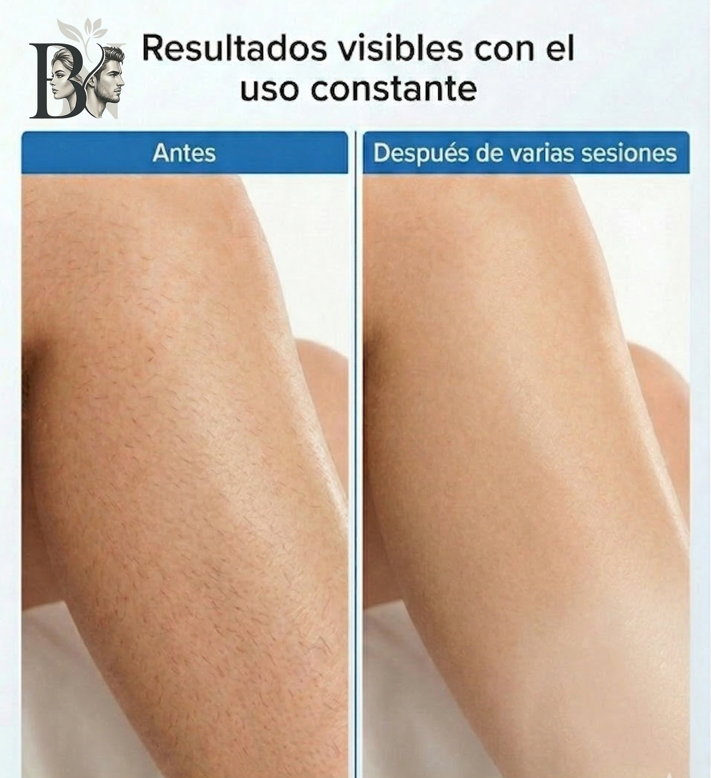 NovaSkin IPL™  Menos rutinas, más libertad