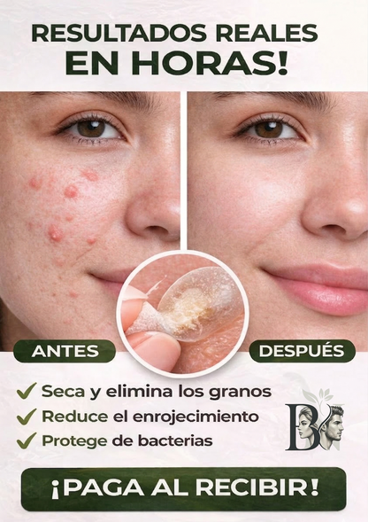 STIKER PARA EL ACNE